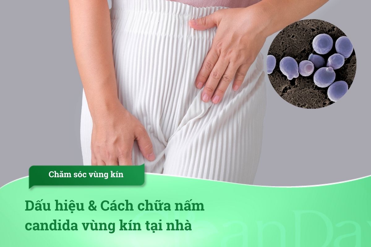 Dấu hiệu & Cách chữa nấm candida vùng kín tại nhà