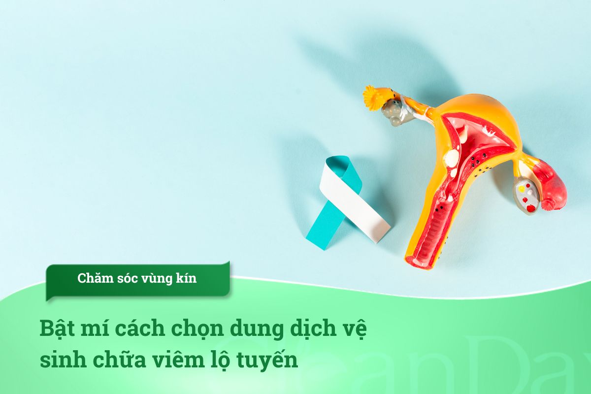 Bật mí cách chọn dung dịch vệ sinh chữa viêm lộ tuyến